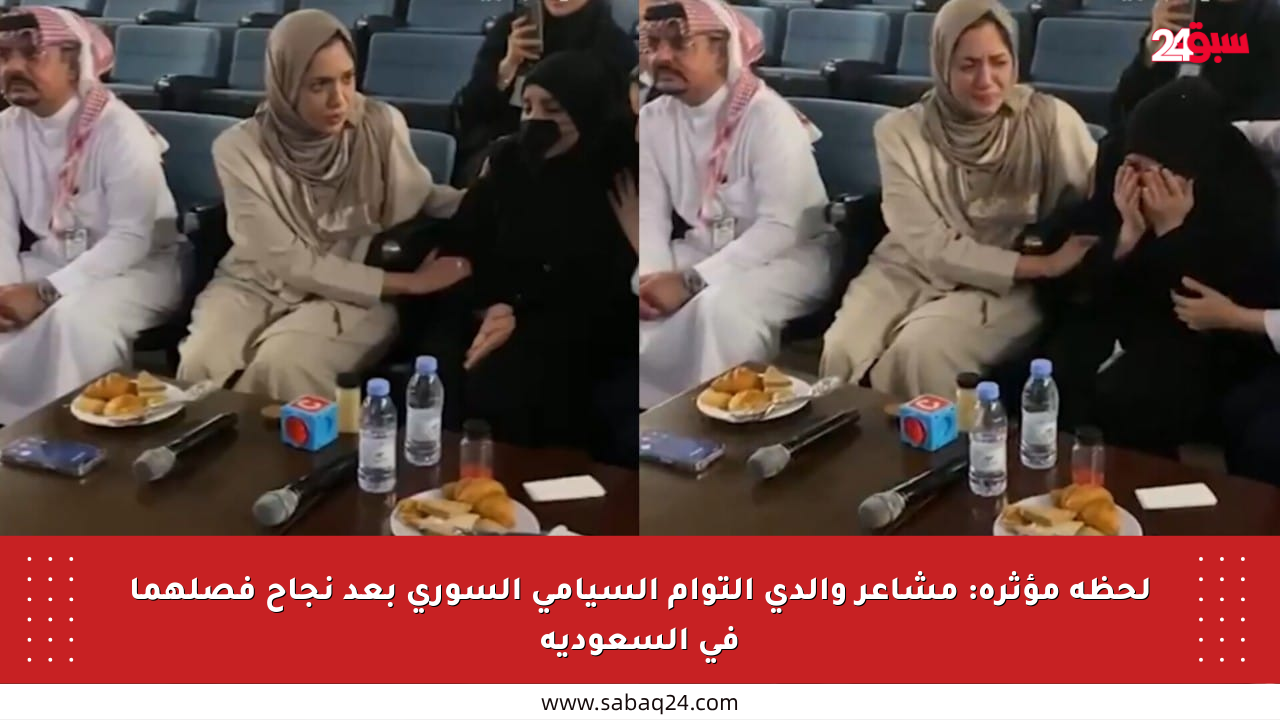 لحظة مؤثرة: مشاعر والدي التوأم السيامي السوري بعد نجاح فصلهما في السعودية